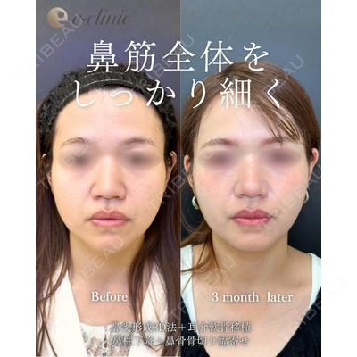 eクリニック 福岡院 伊藤 渉医師の症例