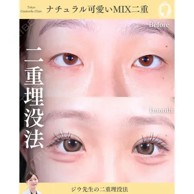 東京シンデレラ美容外科 新宿院 金智優医師の症例