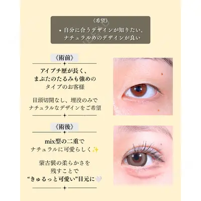 東京シンデレラ美容外科 新宿院 金智優医師の症例