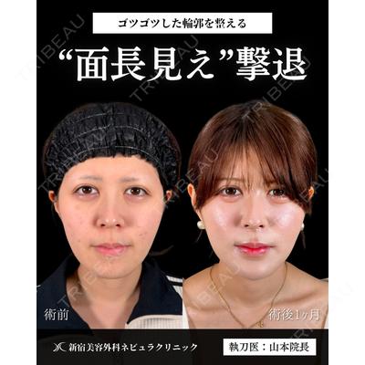 新宿美容外科ネビュラクリニック 山本 紘子医師の症例