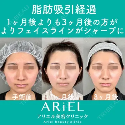 アリエル美容クリニック 大宮院 鈴木　桂介医師の症例