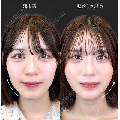 TCB東京中央美容外科 秋葉原院の症例