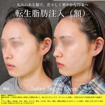 Tokyo Tensei Clinic 新宿院 菅田郁也医師の症例