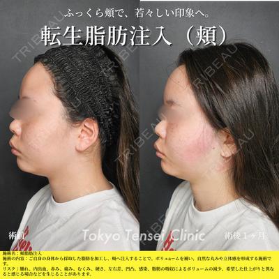 Tokyo Tensei Clinic 新宿院 小瀬 洸春医師の症例