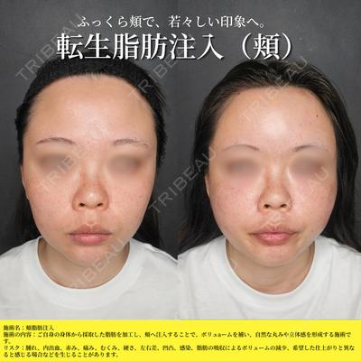 Tokyo Tensei Clinic 新宿院 小瀬 洸春医師の症例
