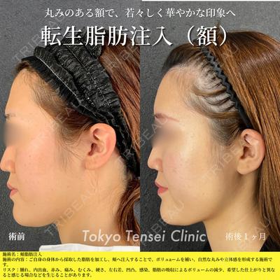 Tokyo Tensei Clinic 新宿院 辻 大成医師の症例