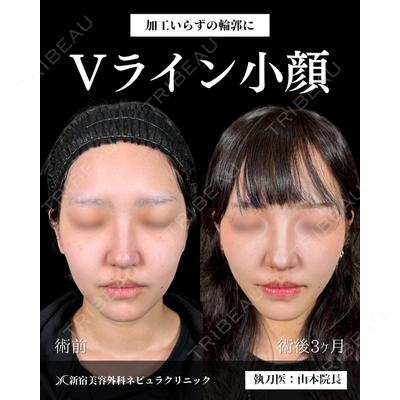 新宿美容外科ネビュラクリニック 山本 紘子医師の症例