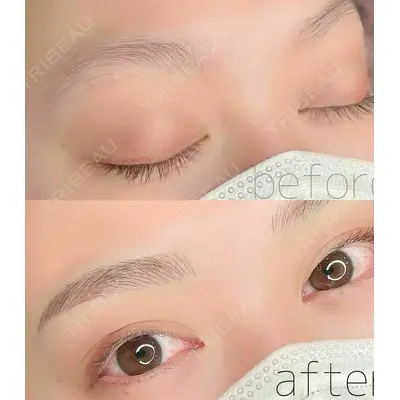 LEAGRANT CLINIC 中目黒 谷上 奈緒子医師の症例