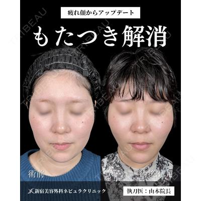 新宿美容外科ネビュラクリニック 山本 紘子医師の症例