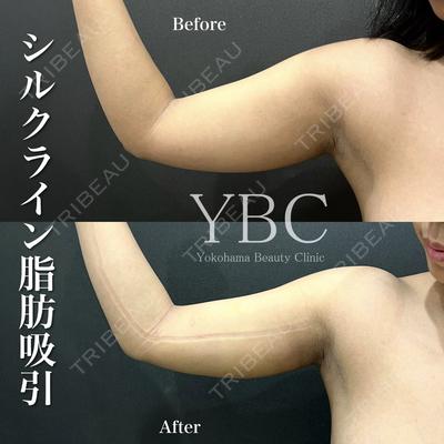 YBC横浜美容外科 立川院 塚原健汰医師の症例