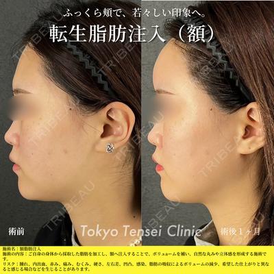 Tokyo Tensei Clinic 大阪梅田院 岩本優輝医師の症例