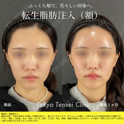 Tokyo Tensei Clinic 大阪梅田院 岩本優輝医師の症例
