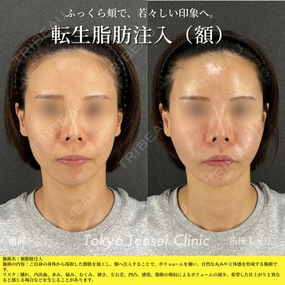 Tokyo Tensei Clinic 新宿院 菅田郁也医師の症例