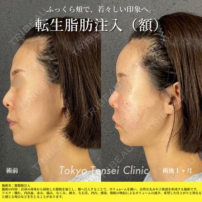 Tokyo Tensei Clinic 新宿院 菅田郁也医師の症例