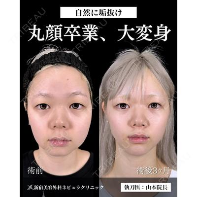 新宿美容外科ネビュラクリニック 山本 紘子医師の症例