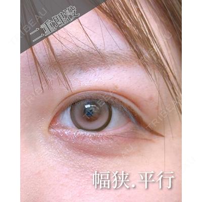 eクリニック 東京院 劉 奕阳医師の症例