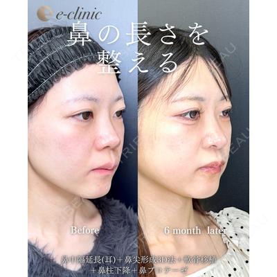 eクリニック 福岡院の症例