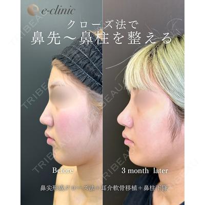 eクリニック 福岡院 伊藤 渉医師の症例
