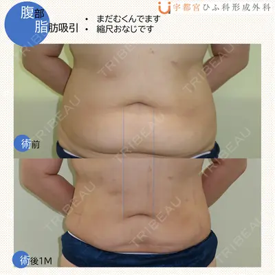 宇都宮ひふ科形成外科 宇都宮 裕己医師の症例
