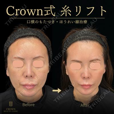 CROWN BEAUTY CLINIC 神山 豊医師の症例