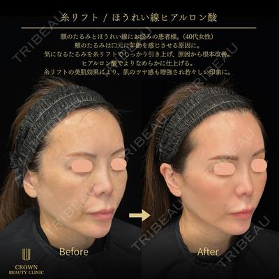 CROWN BEAUTY CLINIC 神山 豊医師の症例