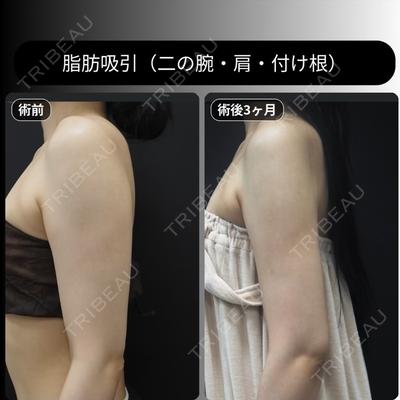 下北沢スキンクリニックの症例