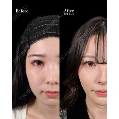新宿美容外科ネビュラクリニック 山本 紘子医師の症例
