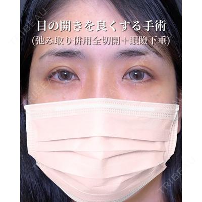 eクリニック 東京院 劉 奕阳医師の症例