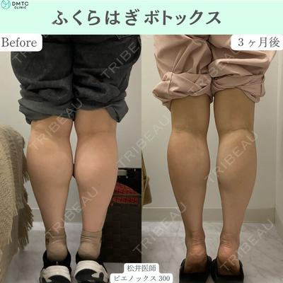 DMTC CLINIC 日本橋院 松井泉医師の症例