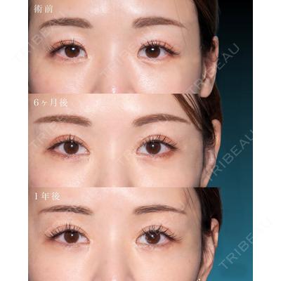 TCB東京中央美容外科 秋葉原院の症例