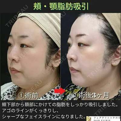 フェアクリニック川口 柴田 健了医師の症例