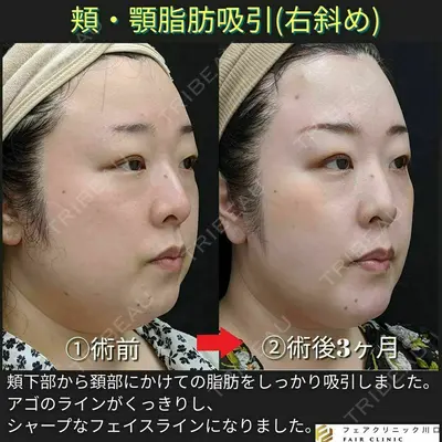 フェアクリニック川口 柴田 健了医師の症例