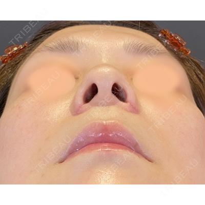 SOL CLINIC 向井 英子医師の症例