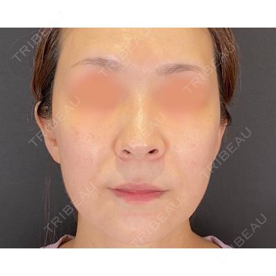 SOL CLINIC 向井 英子医師の症例