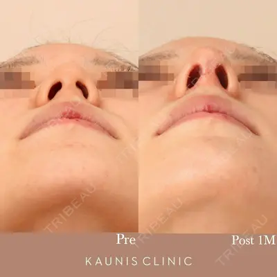 KAUNIS CLINIC（カウニスクリニック） 高野 敏郎医師の症例