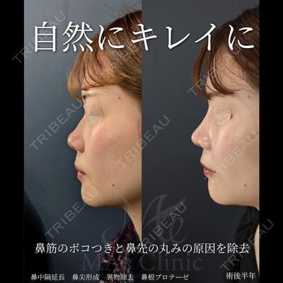 MAe Clinic 東京院 前田 翔医師の症例