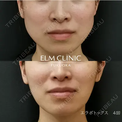 美容皮膚科エルムクリニック 福岡院 白水 翼医師の症例