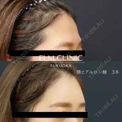 美容皮膚科エルムクリニック 福岡院 白水 翼医師の症例