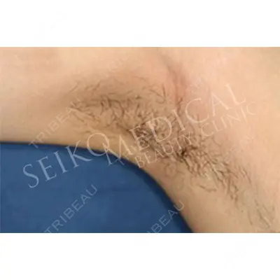 セイコメディカルビューティクリニック 鹿児島院 曽山　聖子医師の症例