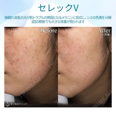 聖心美容クリニック 熱海院 小林 美幸（皮膚科）医師の症例