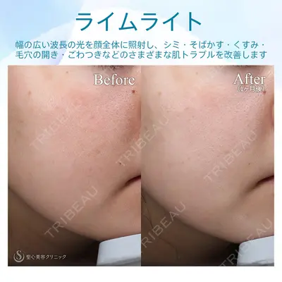 聖心美容クリニック 熱海院 小林 美幸（皮膚科）医師の症例