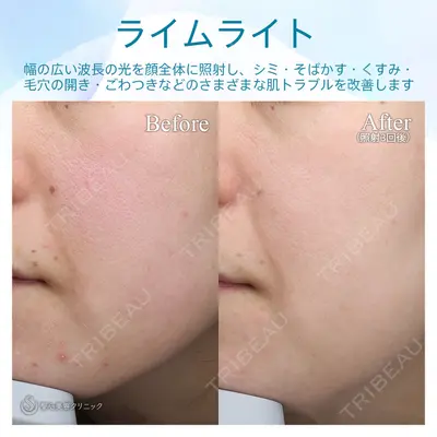 聖心美容クリニック 熱海院 小林 美幸（皮膚科）医師の症例