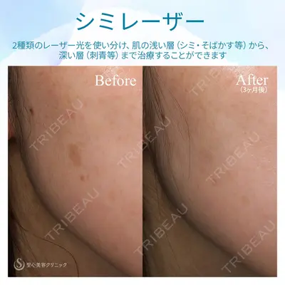 聖心美容クリニック 熱海院 小林 美幸（皮膚科）医師の症例