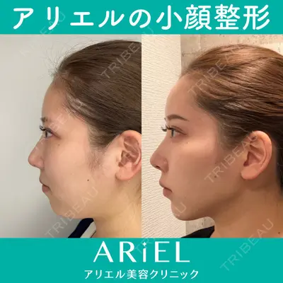 アリエル美容クリニック 大宮院 鈴木　桂介医師の症例