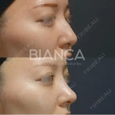BIANCA銀座 堀田 和亮医師の症例
