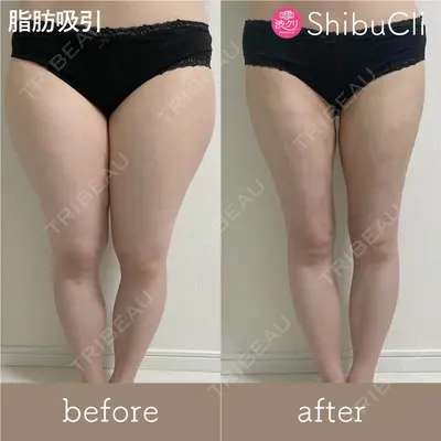 渋谷美容外科クリニック 渋谷院 中島 透医師の症例