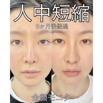 ルラ美容クリニック 渋谷本院 武内 大医師の症例