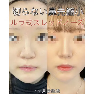 ルラ美容クリニック 渋谷本院 武内 大医師の症例