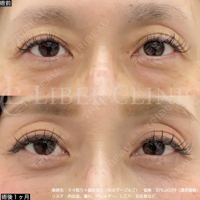 LIBER CLINIC 矢橋 洋一郎医師の症例