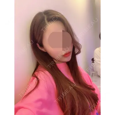 TL美容整形外科 顔面輪郭・目・鼻センター チェ・セウン医師の症例